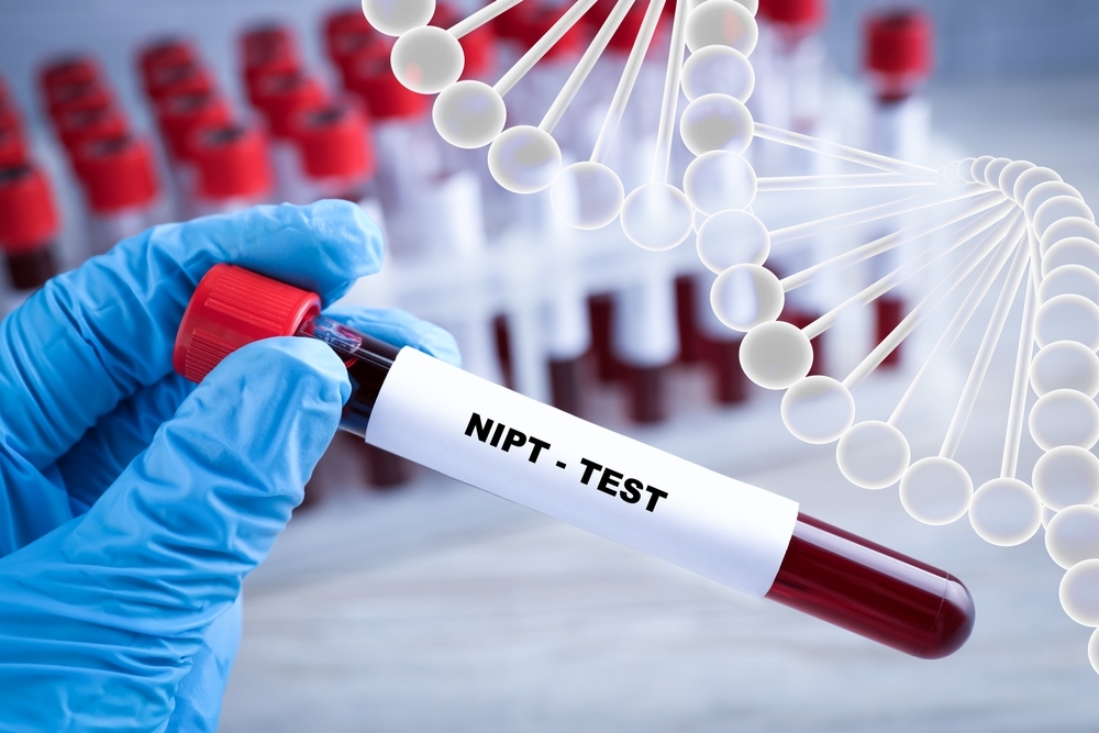 Noninvasive,Prenatal,Testing,(nipt).,Nurse,Holding,Test,Tube,With,Blood
